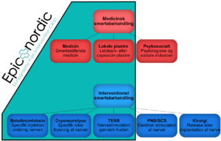 Behandling neuropatiske smerter