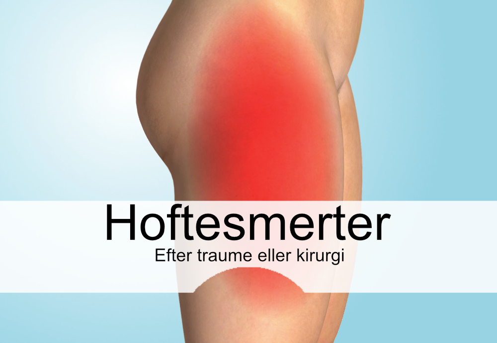 Hoftesmerter