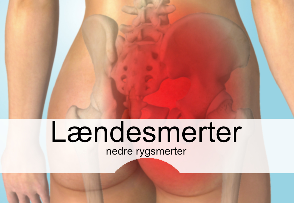 Lændesmerter