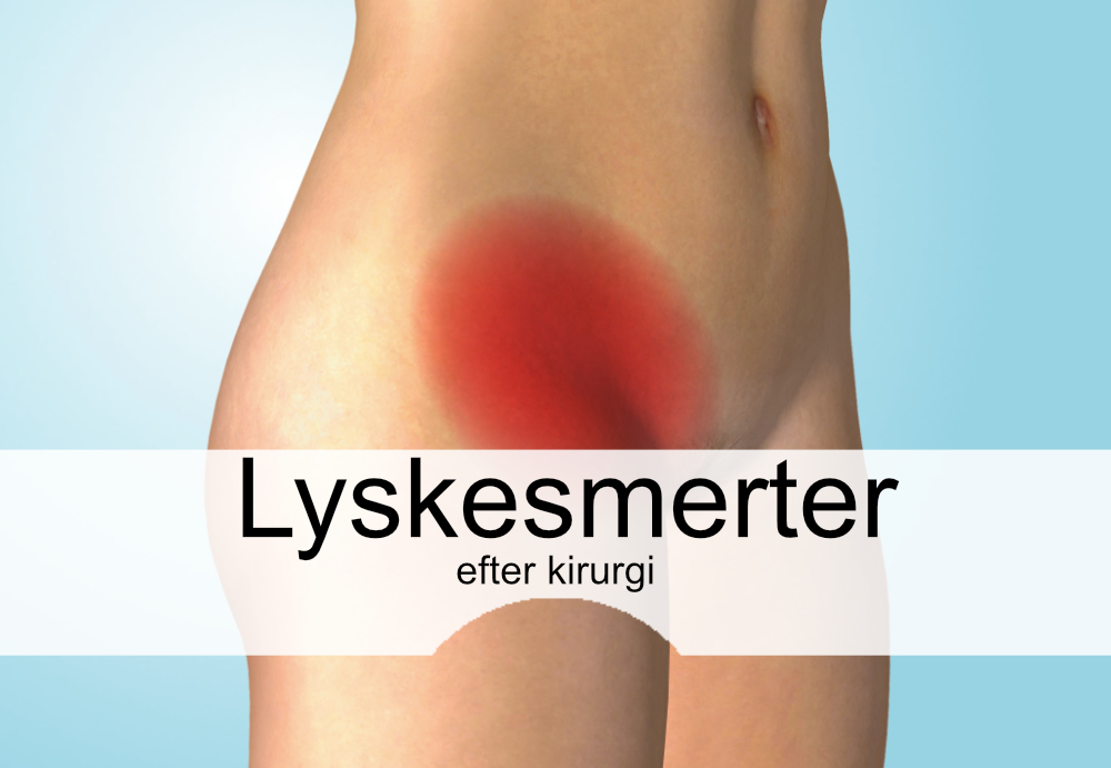 Lyskesmerter