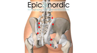 Bækkensmerter ligamenter